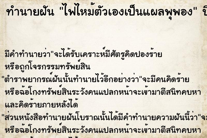 ทำนายฝัน ไฟไหม้ตัวเองเป็นแผลพุพอง