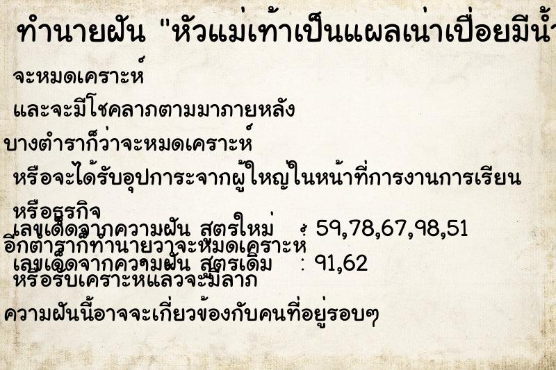 ทำนายฝัน หัวแม่เท้าเป็นแผลเน่าเปื่อยมีน้ำเหลือง