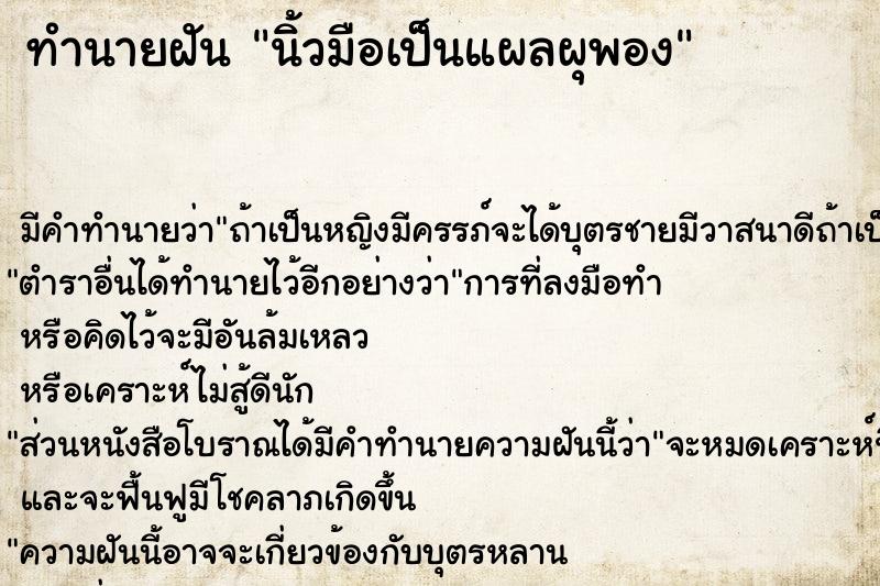 ทำนายฝัน นิ้วมือเป็นแผลผุพอง