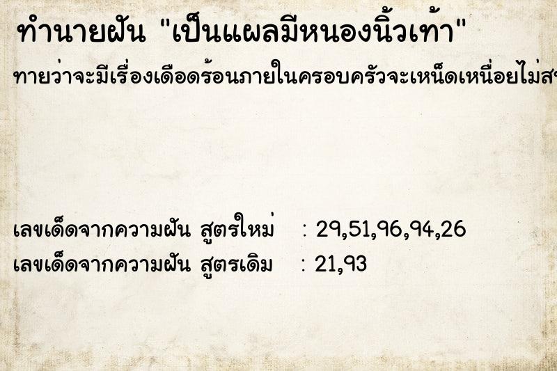 ทำนายฝัน เป็นแผลมีหนองนิ้วเท้า  เลขนำโชค 