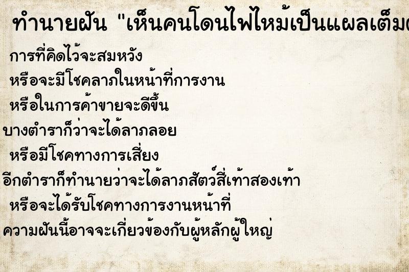 ทำนายฝัน เห็นคนโดนไฟไหม้เป็นแผลเต็มตัวเลย