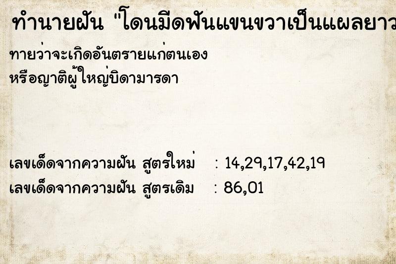 ทำนายฝัน โดนมีดฟันแขนขวาเป็นแผลยาวมาก1แผล