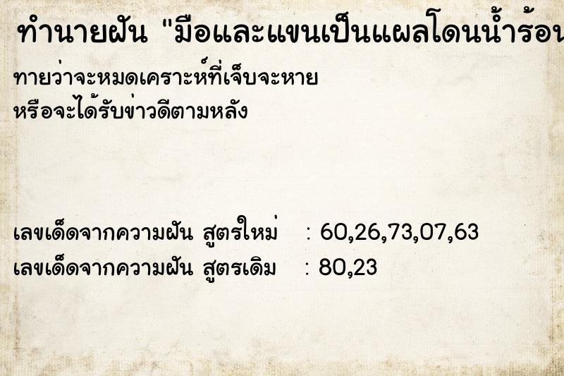 ทำนายฝัน มือและแขนเป็นแผลโดนน้ำร้อนลวก