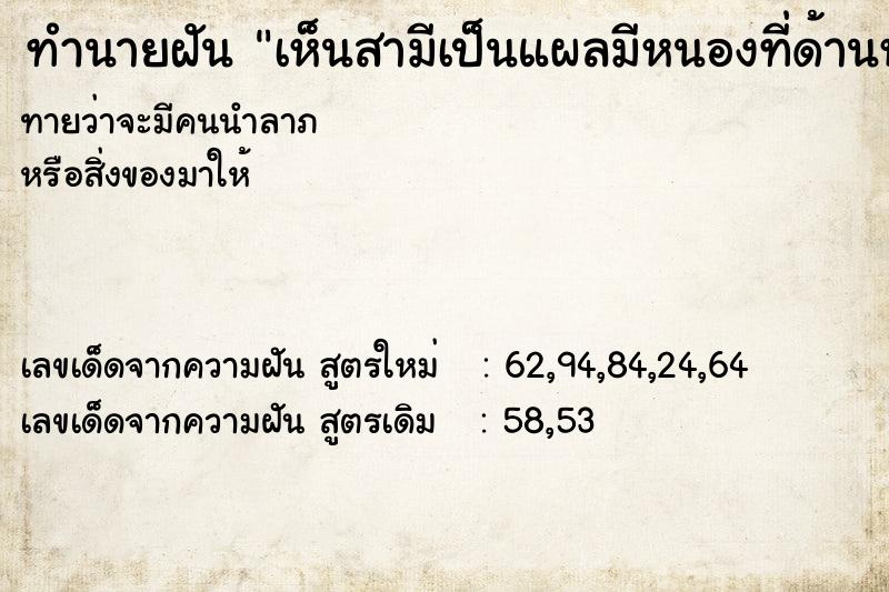 ทำนายฝัน เห็นสามีเป็นแผลมีหนองที่ด้านหลัง